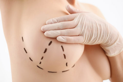 CURE DE PTOSE MAMMAIRE  CURE DE PTOSE MAMMAIRE 1 shutterstock 1335919487 scaled 480x320  CHIRURGIE DU SEIN 1 shutterstock 1335919487 scaled 480x320  CHIRURGIE DU SEIN 1 shutterstock 1335919487 scaled 480x320